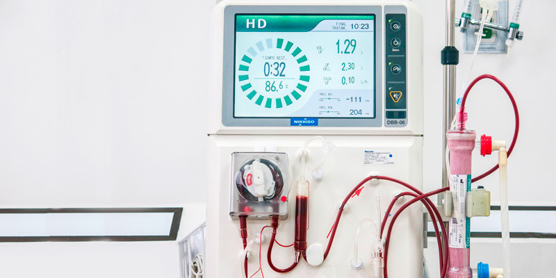 Tratamiento de seguimiento para trasplante renal