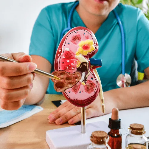 Nefritis Intersticial: Atención Nefrológica Especializada en CDMX